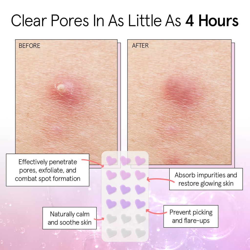 grace & stella Award Winning Pore Strip - Pimple Patches for Face - Hydrocolloid Acne Patches - Absorbs Zits, Reduces Redness - Cute Patches Dermatologist-Tested, Vegan (Multishape, 36 Count)