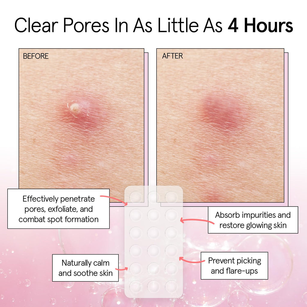 grace & stella Award Winning Pore Strip - Pimple Patches for Face - Hydrocolloid Acne Patches - Absorbs Zits, Reduces Redness - Cute Patches Dermatologist-Tested, Vegan (Multishape, 36 Count)