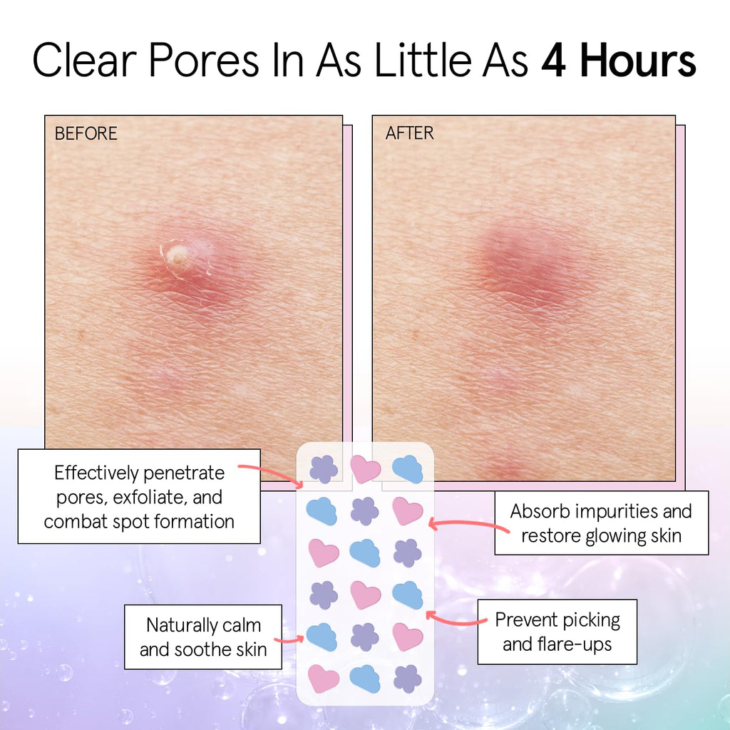 grace & stella Award Winning Pore Strip - Pimple Patches for Face - Hydrocolloid Acne Patches - Absorbs Zits, Reduces Redness - Cute Patches Dermatologist-Tested, Vegan (Multishape, 36 Count)