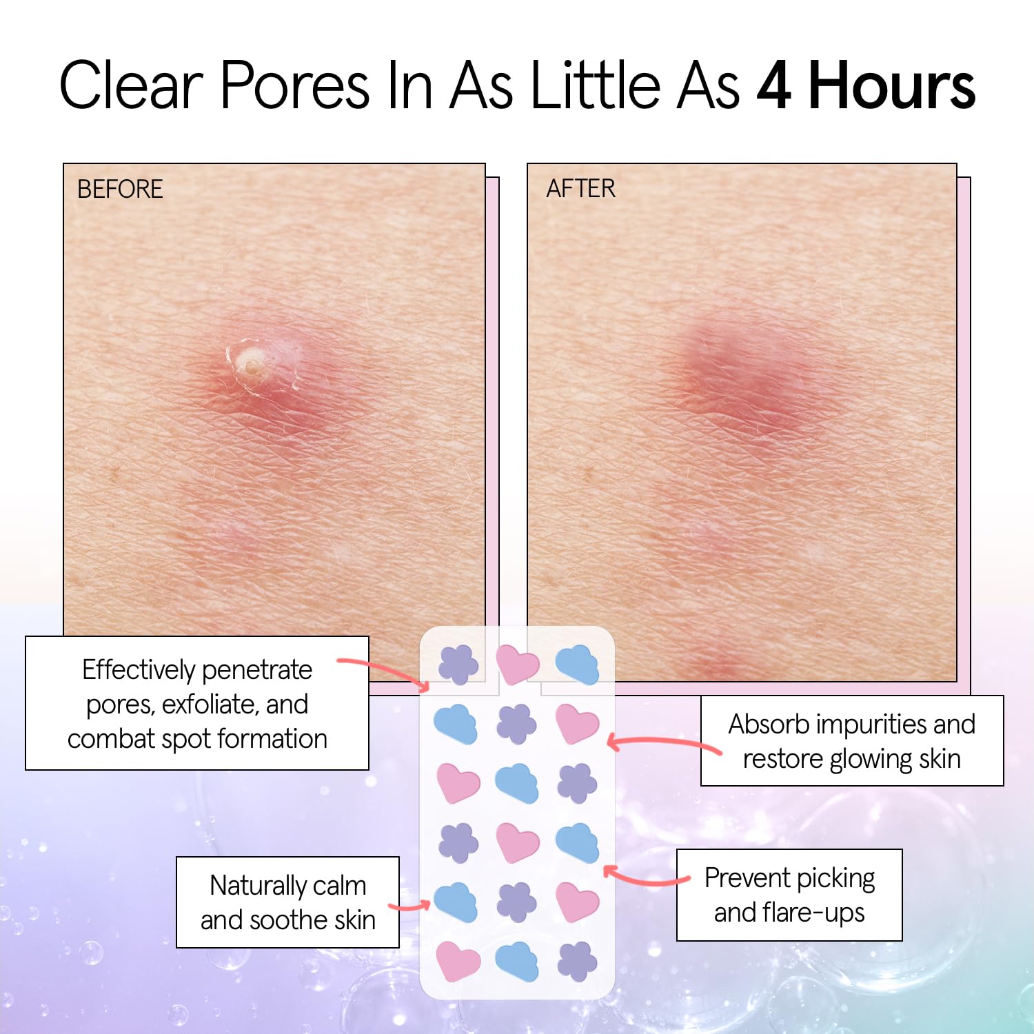 grace & stella Award Winning Pore Strip - Pimple Patches for Face - Hydrocolloid Acne Patches - Absorbs Zits, Reduces Redness - Cute Patches Dermatologist-Tested, Vegan (Multishape, 36 Count)